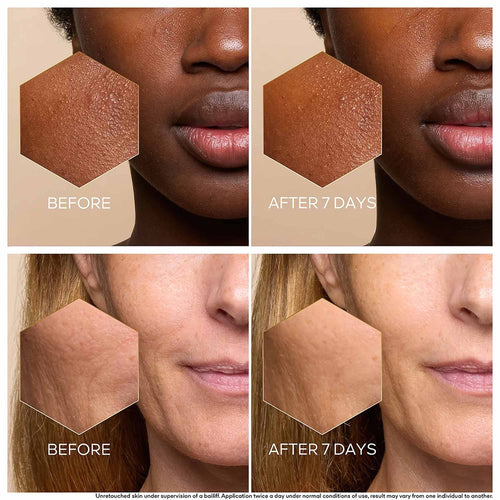 Reverse visible aging at its source